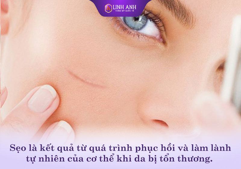 bị sẹo kiêng ăn gì bị sẹo kiêng ăn gì trong bao lâu