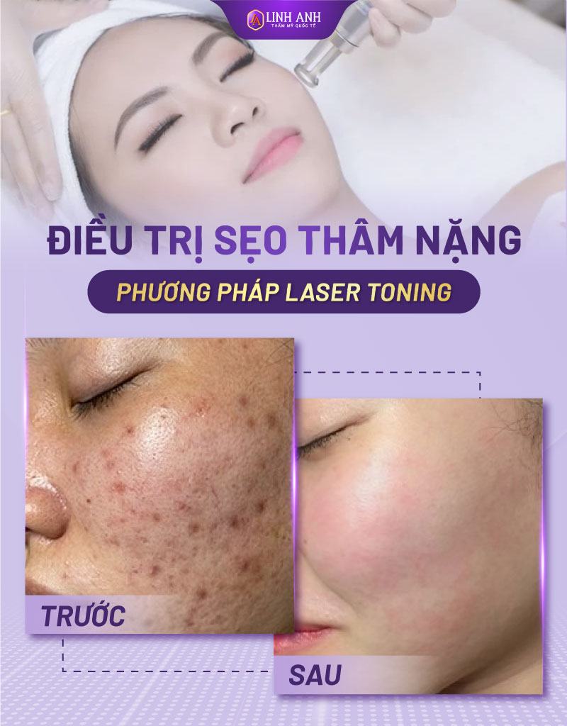 vết thương hở kiêng ăn gì để không bị sẹo bị sẹo rỗ kiêng ăn gì