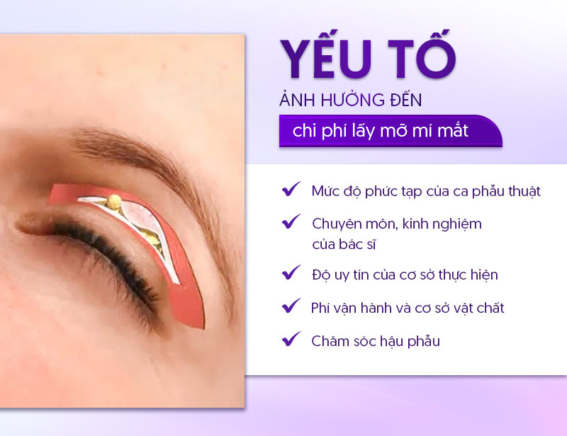 bóc mỡ mí mắt trên giá bao nhiêu bóc mỡ mí mắt trên giá bao nhiêu