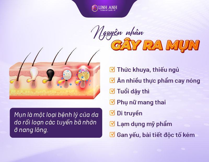 phân biệt các loại mụn các loại mụn
