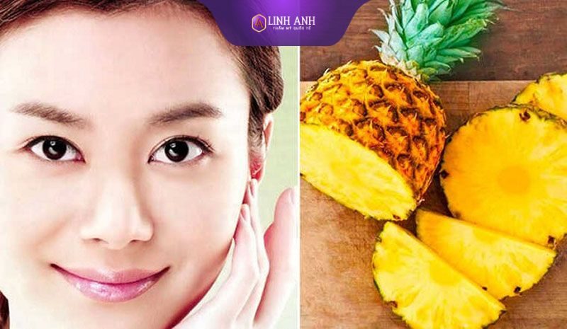 chữa sạm da cách điều trị sạm da