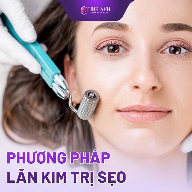 cách trị sẹo rỗ dân gian cách điều trị sẹo rỗ