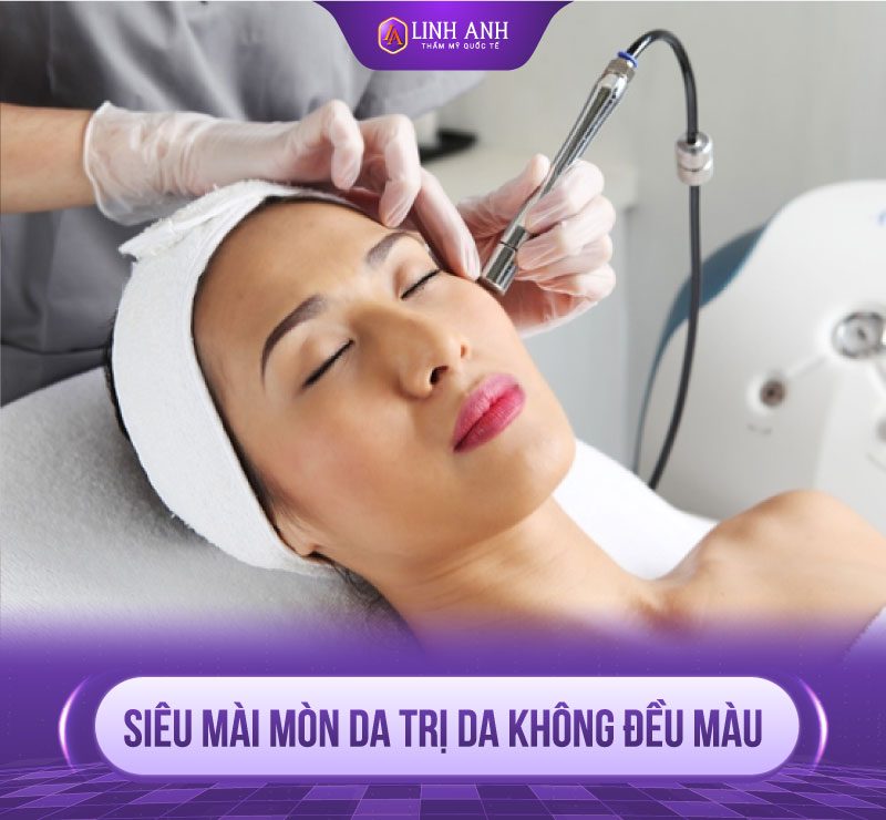 cách khắc phục da không đều màu
