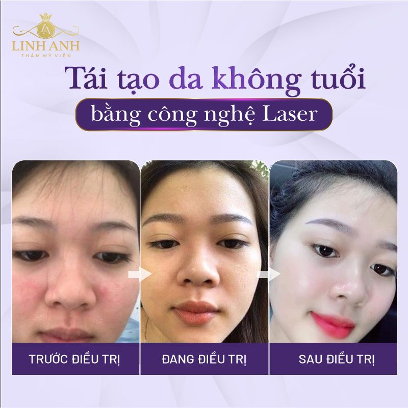 cách đẩy nhanh quá trình tái tạo da cách làm bong da mặt nhanh nhất khi tái tạo