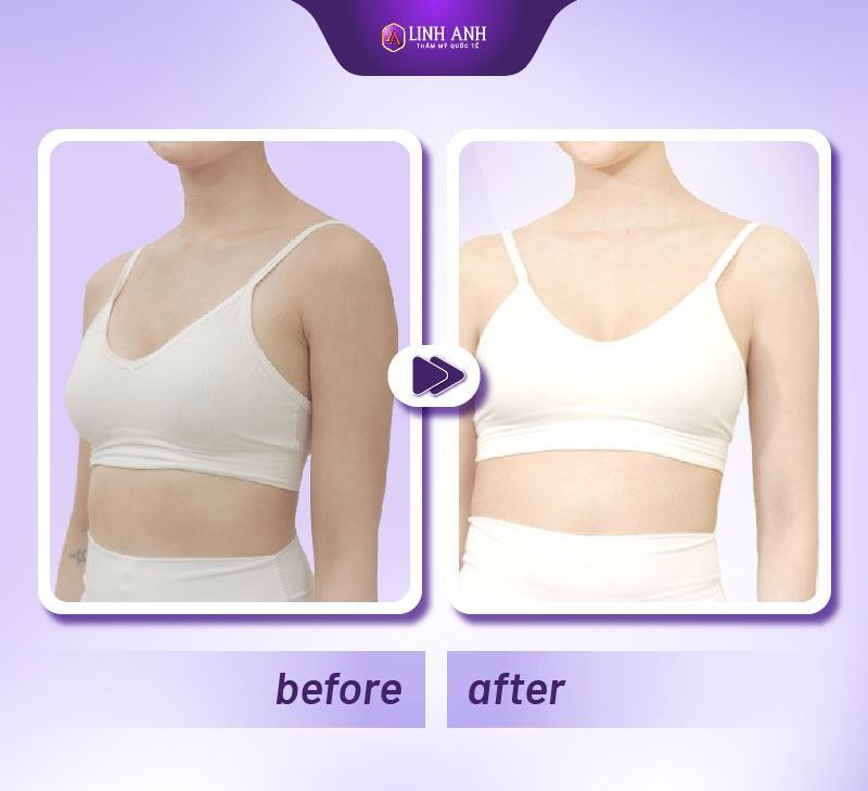 làm trắng da bằng kem đánh răng cách làm trắng da bằng kem đánh răng ps