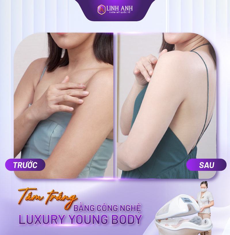 cách làm trắng da toàn thân bằng bia
