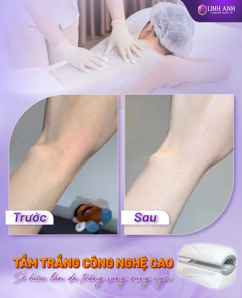 cách làm trắng da toàn thân tại nhà không bắt nắng cách làm trắng da toàn thân cấp tốc