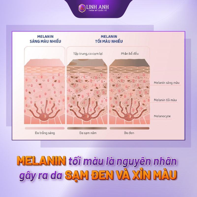cách làm trắng da toàn thân tại nhà không bắt nắng cách làm trắng da toàn thân nhanh nhất