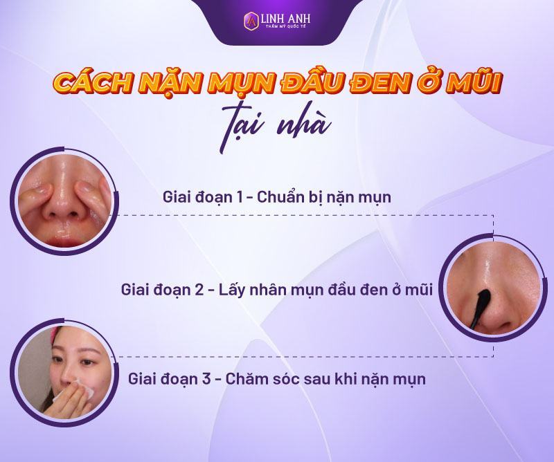 cách nặn mụn đầu đen nặn mụn đầu đen ở mũi