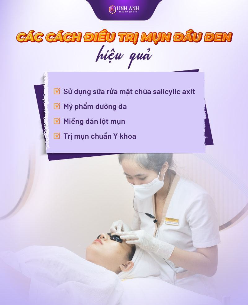 cách nặn mụn đầu đen cách trị mụn đầu đen