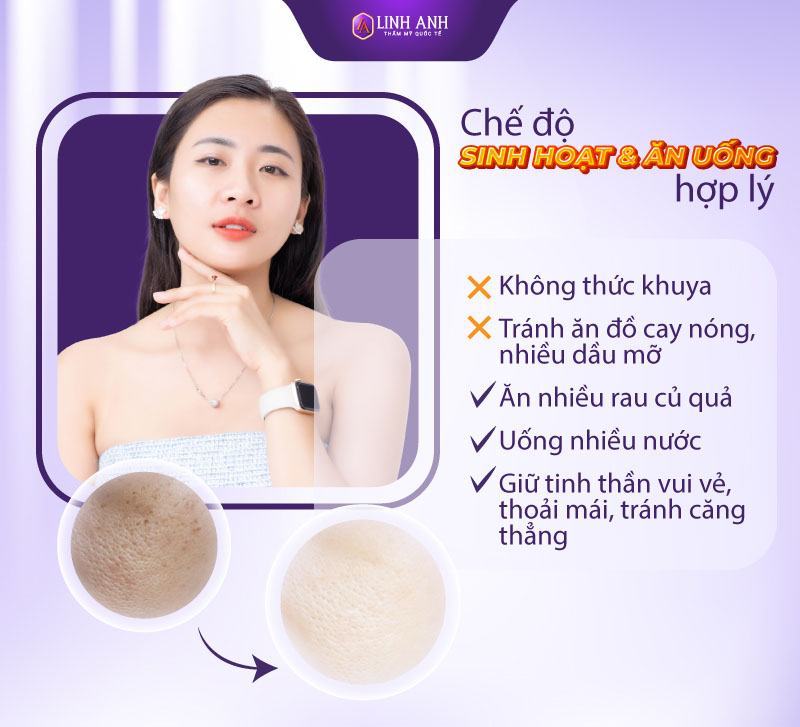 cách se khít lỗ chân lông ở mặt cách se khít lỗ chân lông tại nhà