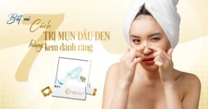 cách trị mụn đầu đen bằng kem đánh răng - Viện thẩm mỹ quốc tế Linh Anh