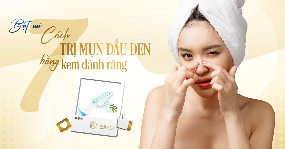 cách trị mụn đầu đen bằng kem đánh răng - Viện thẩm mỹ quốc tế Linh Anh