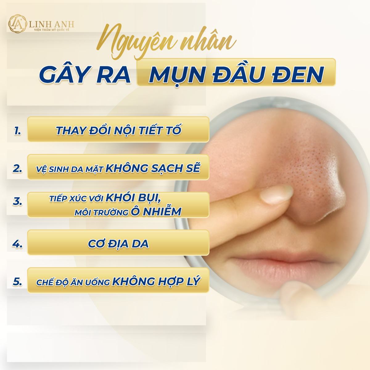 cách trị mụn đầu đen và lỗ chân lông to tại nhà - Viện thẩm mỹ quốc tế Linh Anh cách trị mụn đầu đen và lỗ chân lông to tại nhà - Viện thẩm mỹ quốc tế Linh Anh