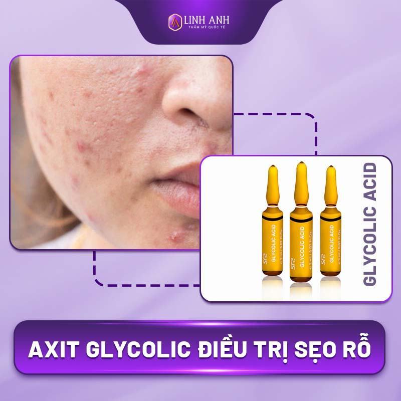 cách trị sẹo rỗ tại nhà cách trị mụn sẹo rỗ