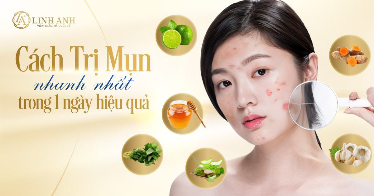 cách trị mụn tại nhà - Viện thẩm mỹ quốc tế Linh Anh