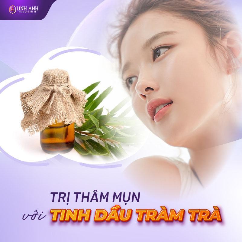 cách trị thâm đỏ 2 bên má cách trị mụn thâm đỏ tại nhà