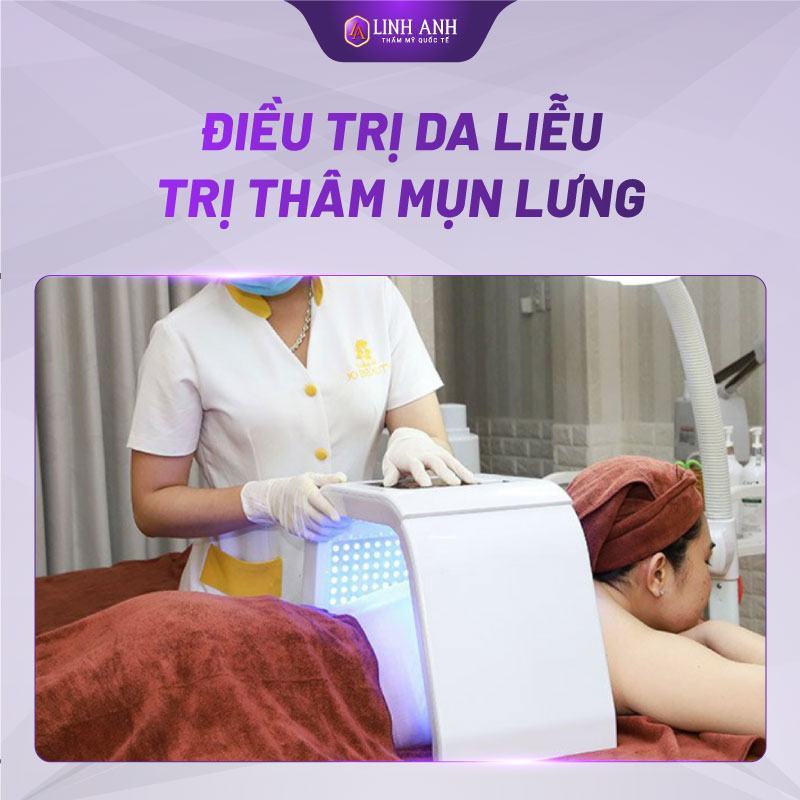 trị thâm mụn lưng lâu năm cách trị mụn thâm ở lưng