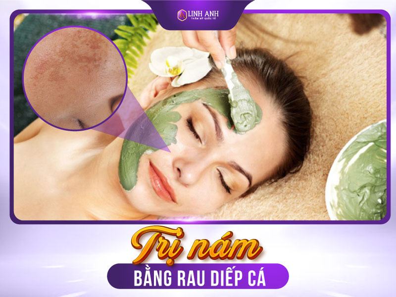 trị nám bằng rau diếp cá cách trị nám bằng rau diếp cá