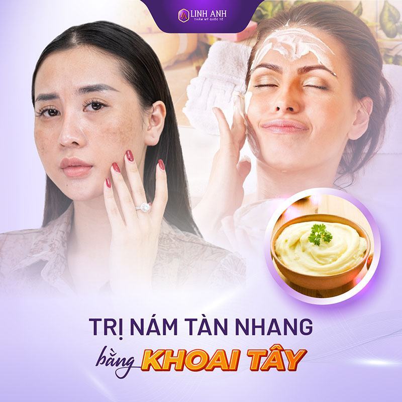 cách trị nám da lâu năm