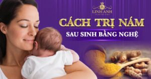 cách trị nám sau sinh bằng nghệ