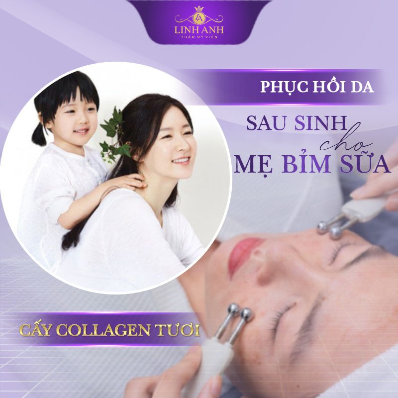 cách trị nám sau sinh bằng nghệ đơn giản