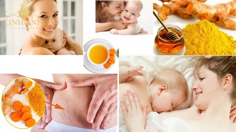 trị nám sau sinh bằng nghệ cách trị nám sau sinh bằng nghệ tươi