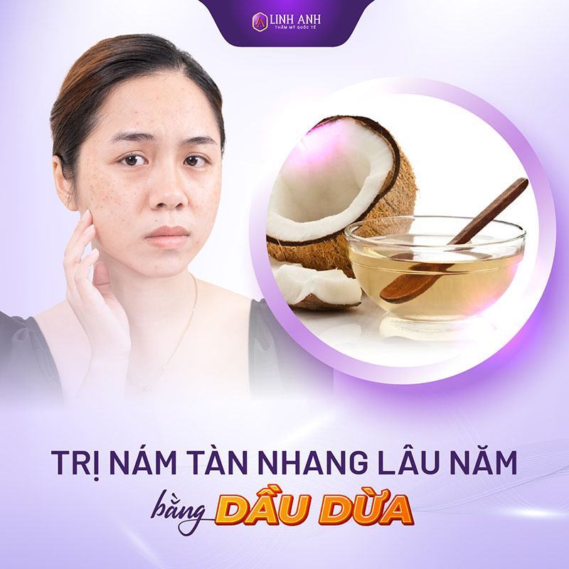 cách trị nám tàn nhang lâu năm bằng dầu dừa