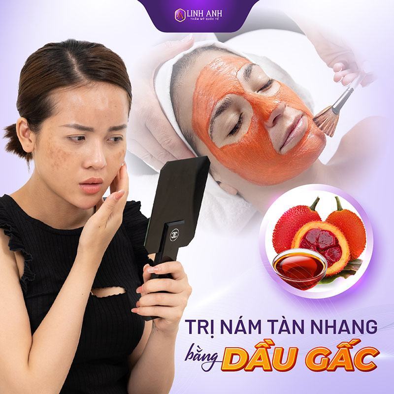 cách trị nám da mặt lâu năm cách trị nám tàn nhang lâu năm