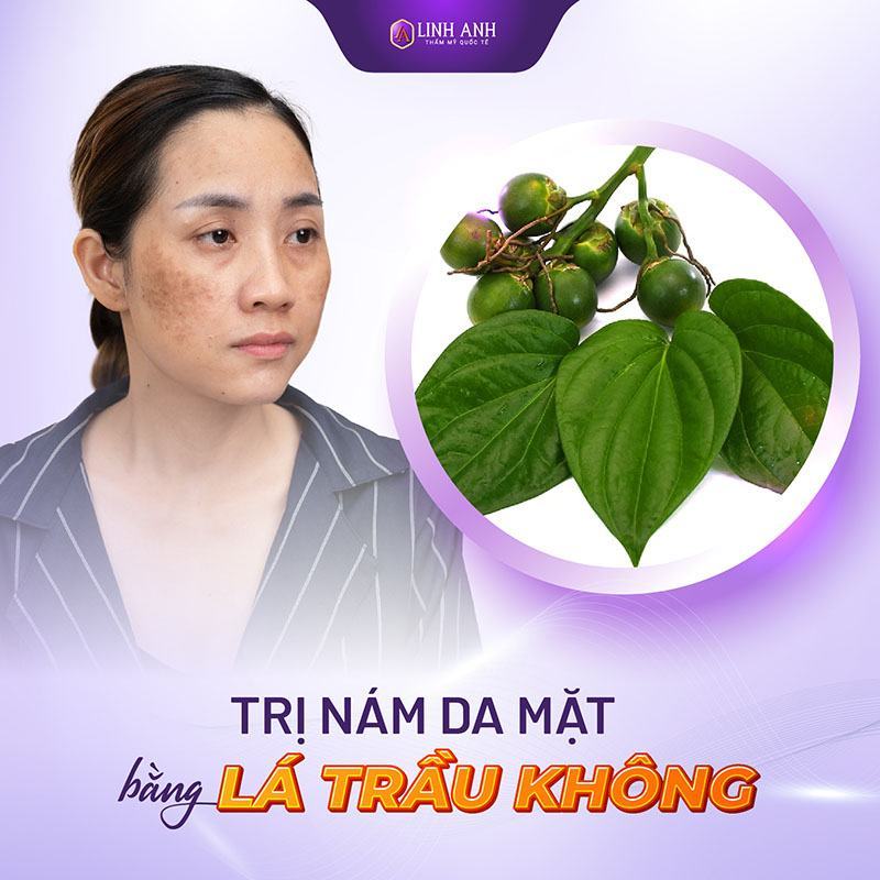 cách trị nám cách trị nám tàn nhang lâu năm bằng lá trầu không