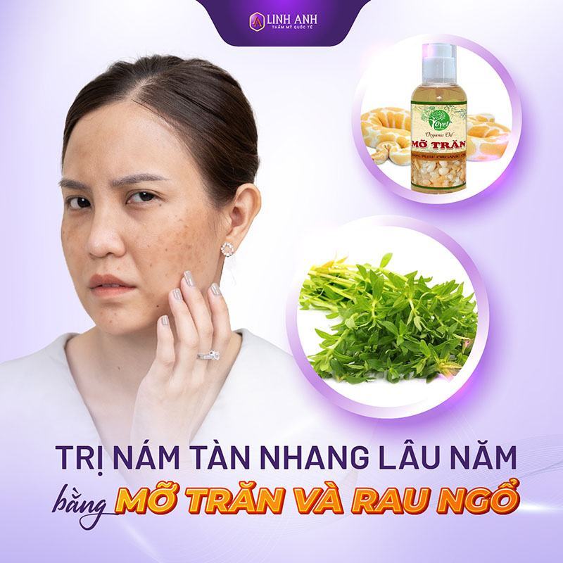 cách trị nám tàn nhang lâu năm bằng mỡ trăn và rau ngổ