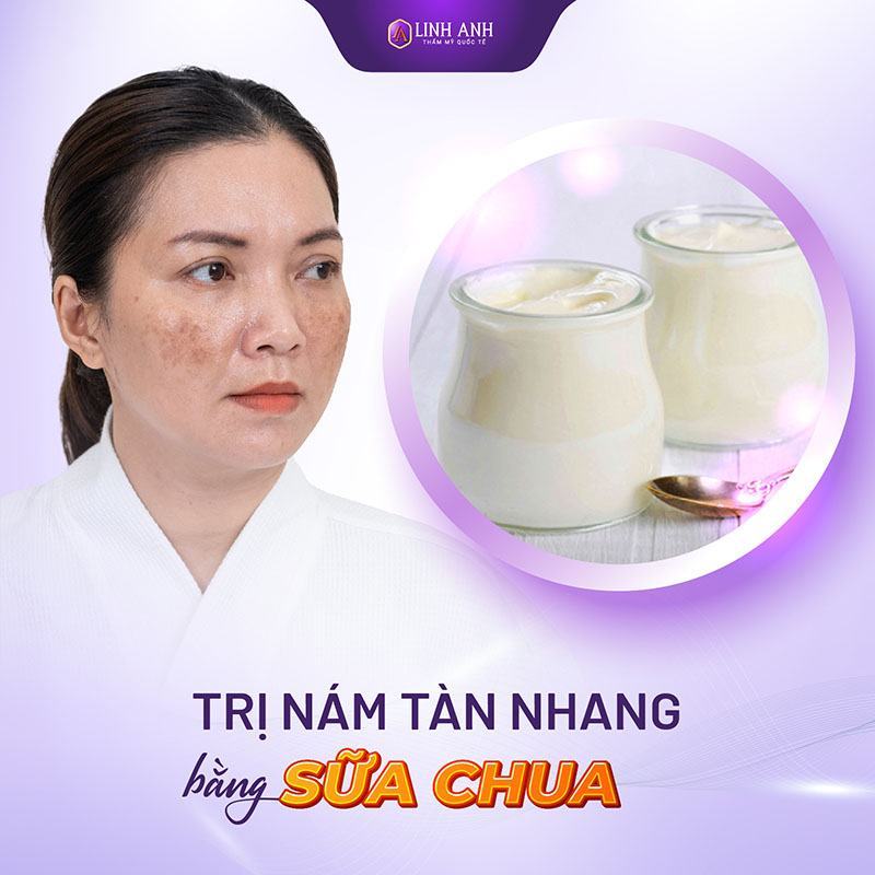 cách trị nám tàn nhang lâu năm bằng sữa chua