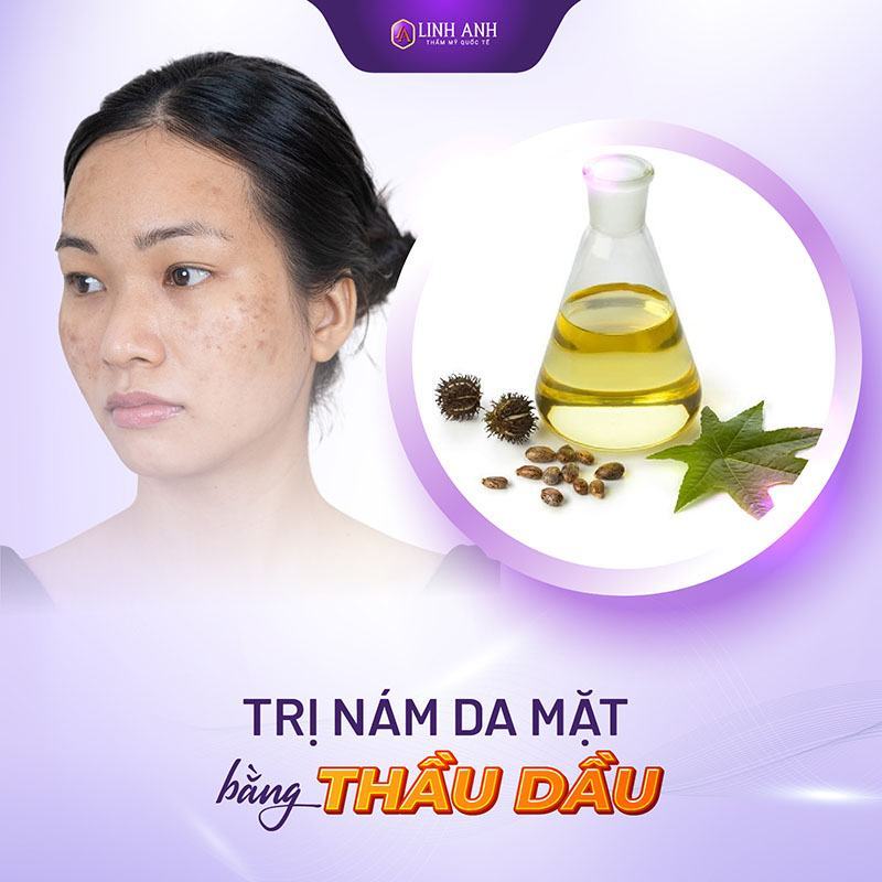 cách trị nám tàn nhang lâu năm bằng thầu dầu