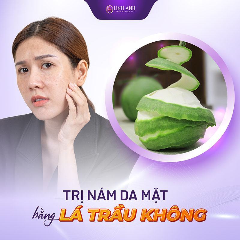 cách trị nám da mặt lâu năm cách trị nám tàn nhang lâu năm bằng vỏ bưởi
