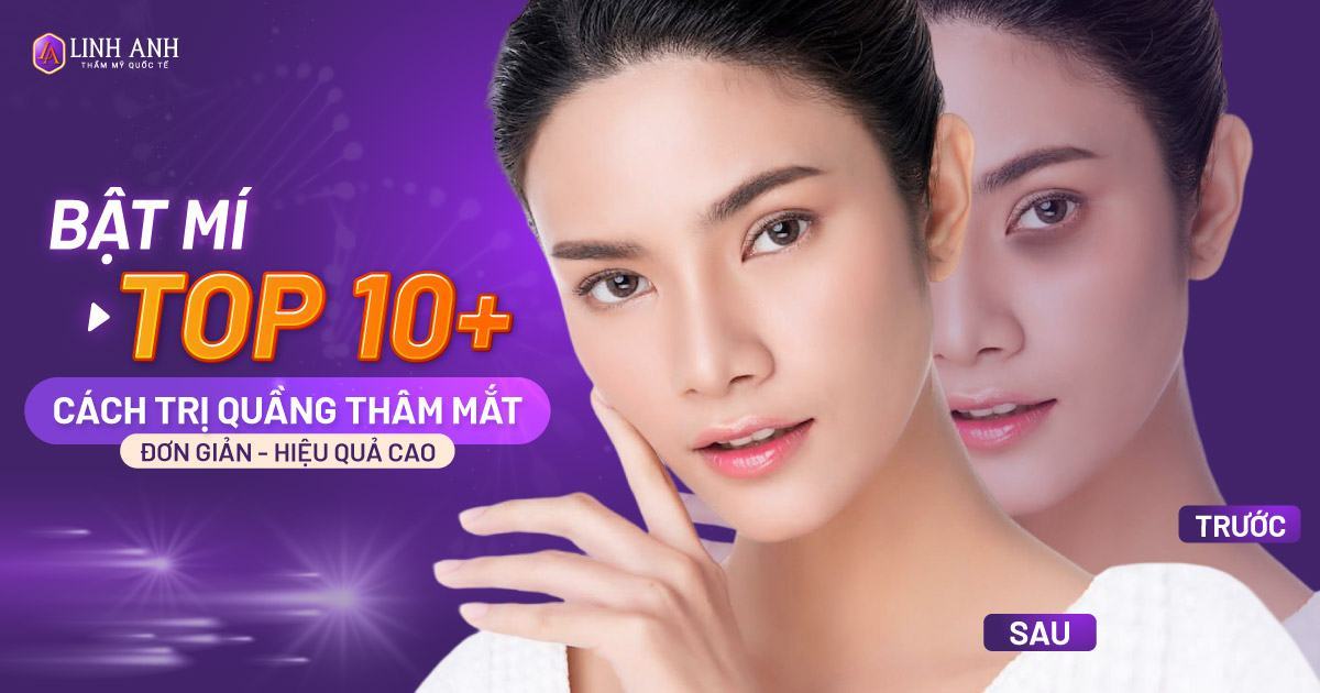 cách trị quầng thâm mắt
