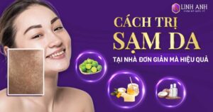 cach tri sam da