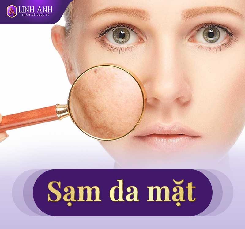 cách trị sạm da cách trị sạm da mặt