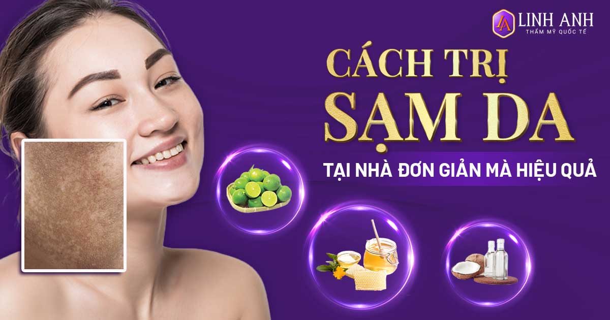 Top 12 cách trị sạm da tại nhà đơn giản và hiệu quả nhất