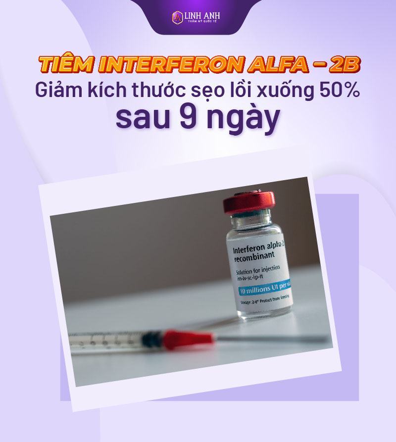 cách trị sẹo lồi tốt nhất cách trị sẹo lồi tốt nhất