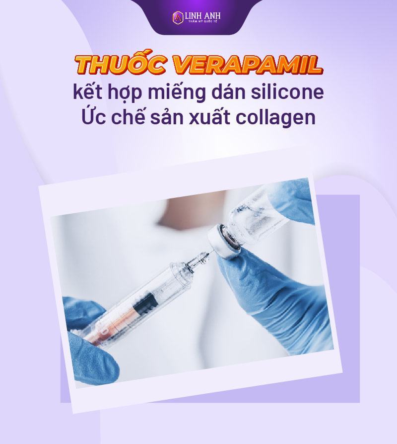kem trị sẹo lồi cách trị sẹo lồi tốt