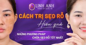 cách trị sẹo rỗ