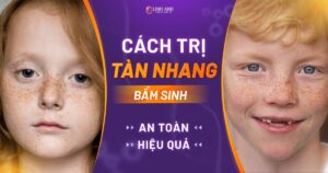 cách trị tàn nhang bẩm sinh