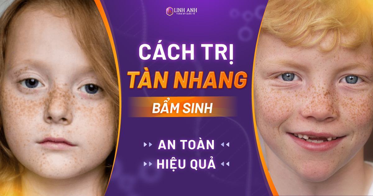 Tàn nhang bẩm sinh là gì? Cách trị tàn nhang bẩm sinh hiệu quả