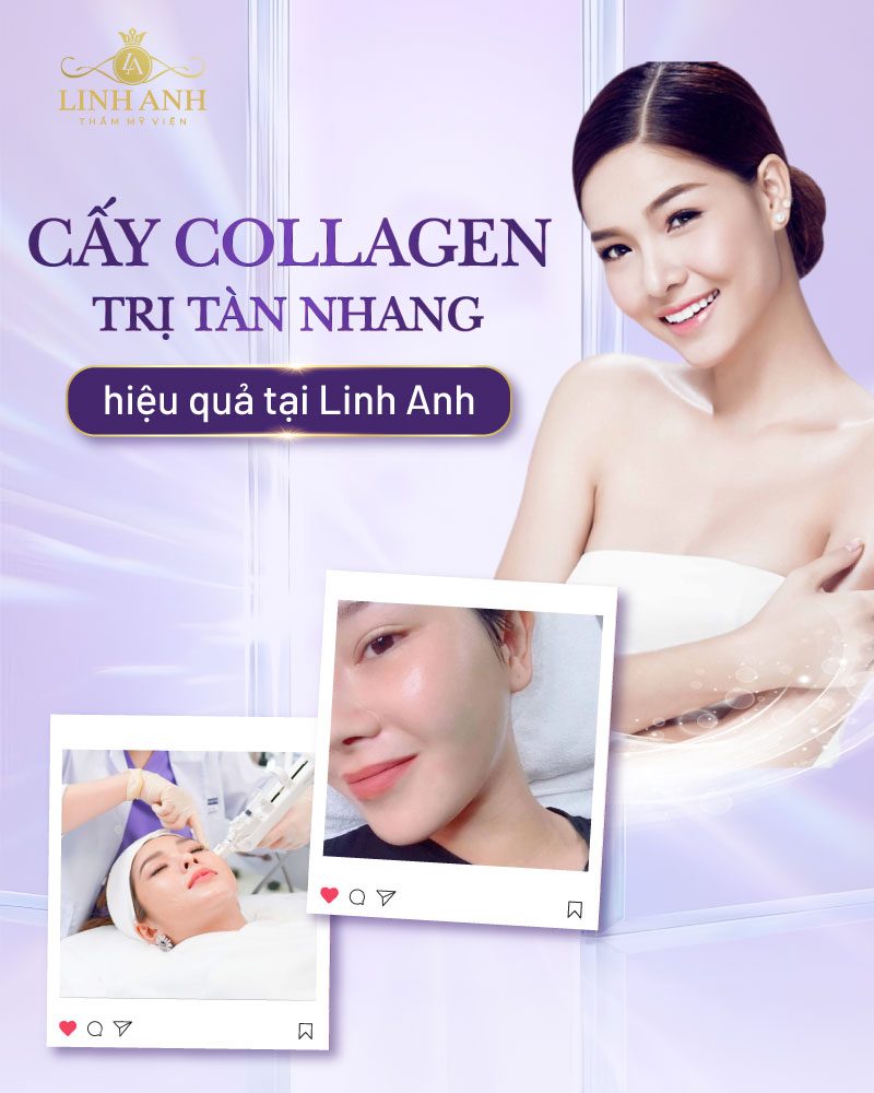 trị tàn nhang bằng kem đánh răng cách trị tàn nhang bằng kem đánh răng tại nhà