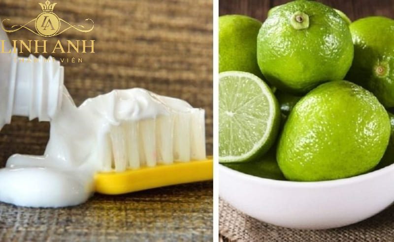 cách trị tàn nhang bằng kem đánh răng cách trị tàn nhang bằng kem đánh răng và chanh