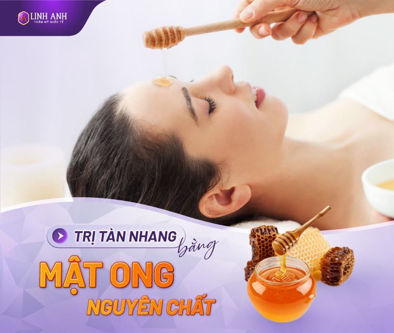 cách trị tàn nhang bằng mật ong hiệu quả