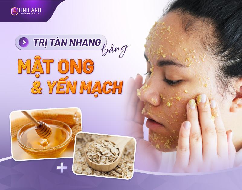 cách trị tàn nhang bằng mật ong hữu ích
