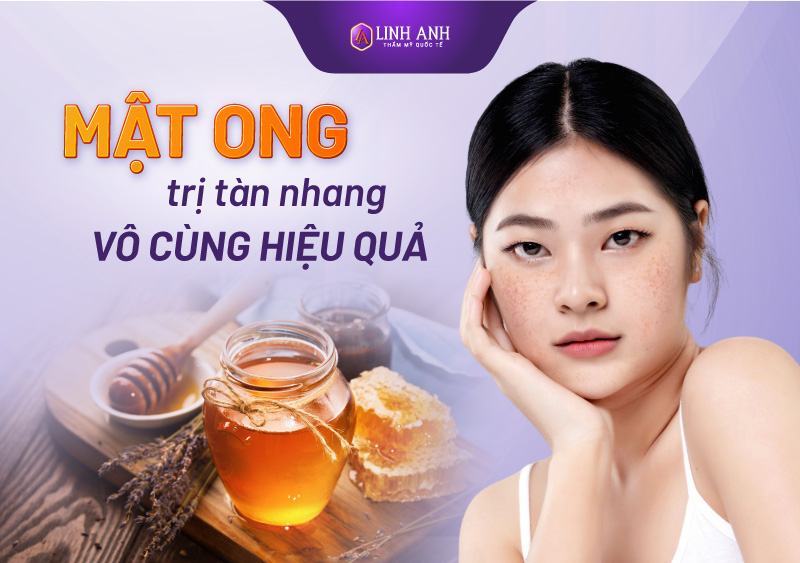 cách trị tàn nhang bằng mật ong tại nhà