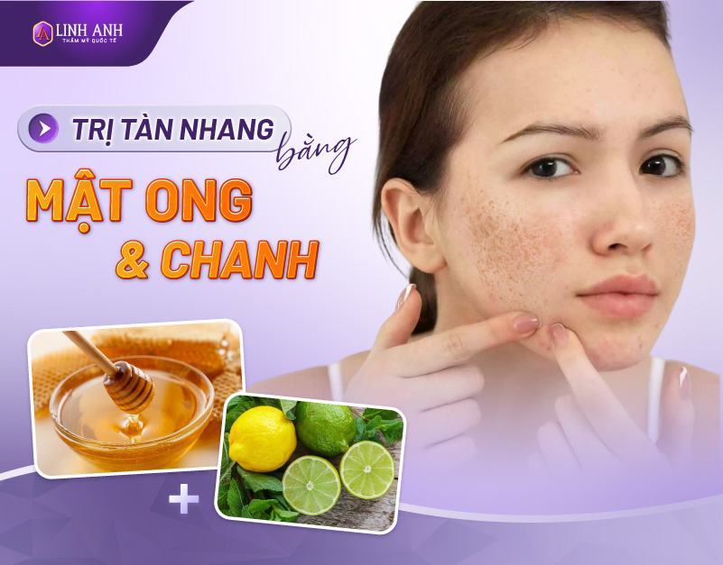 cách trị tàn nhang bằng mật ong và chanh