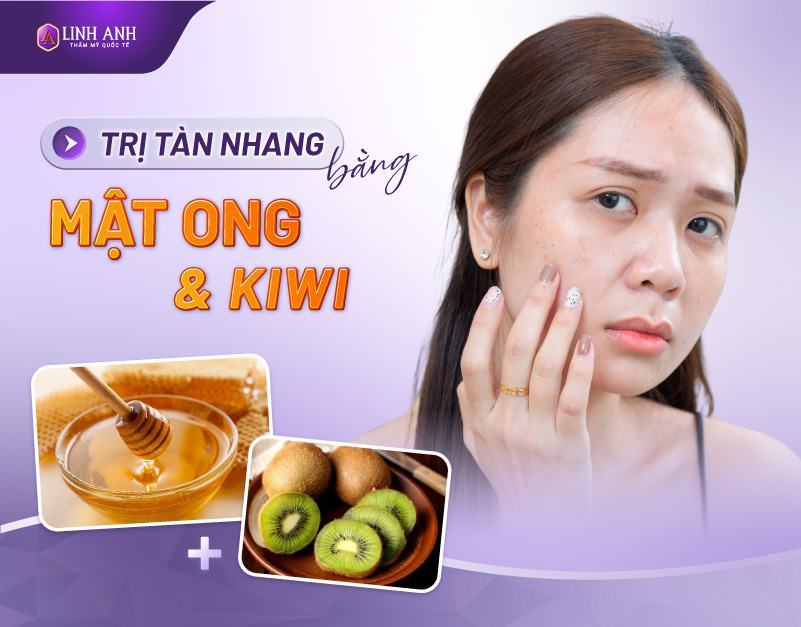 cách trị tàn nhang bằng mật ong và kiwi